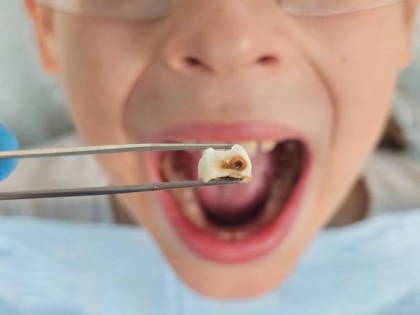 Best Emergency Dentist for Special Needs Patients in Corning, AR