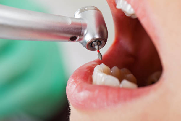Best Broken or Cracked Tooth Emergency Dentist in Corning, AR